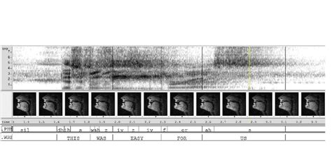 Go Transcript Audio MRI 的图像结果
