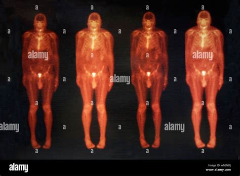Image result for Total Body Scan