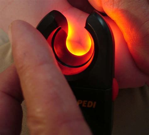 Image result for Transillumination