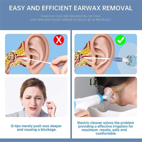 Electric Ear Wax Removal System with 15 Disposable Tips - Earwax Cleaning Kit for Safe and ...