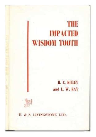 Impacted Wisdom Tooth : Killey, H.C., Kay, L.W.: Amazon.in: Books