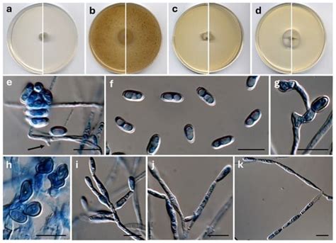 Journal of Fungi | An Open Access Journal from MDPI
