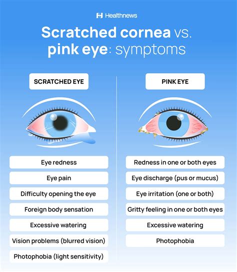 Pink Eye Drops For Scratched Cornea at Will Jarman blog