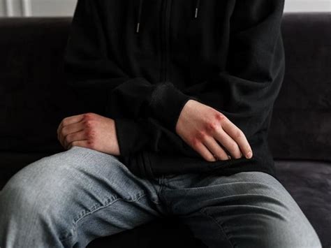 Study: Autism, ADHD, school absence are risk factors for self-harm