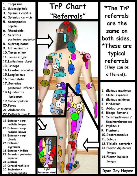 Female Referred Pain Chart - Educational Chart Resources