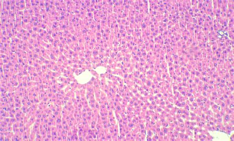 Chest Colorizer 的图像结果