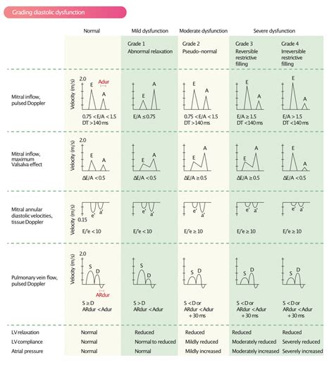 Assessment of diastolic function by echocardiography – The Cardiovascular