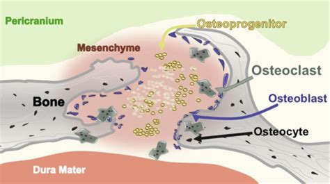 Process Bone 的图像结果