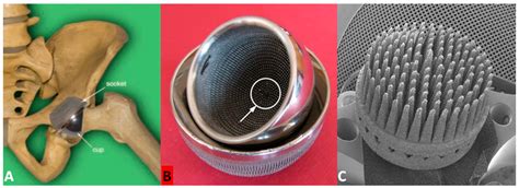 Biomimetic Multispiked Connecting Ti-Alloy Scaffold Prototype for ...