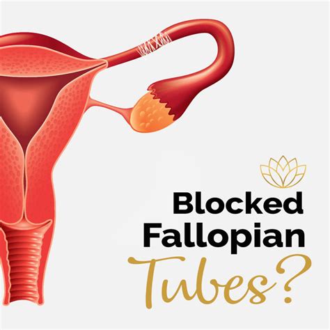 FTR - Symptoms and causes of Blocked Fallopian Tubes - Fibroid Treatment Clinic