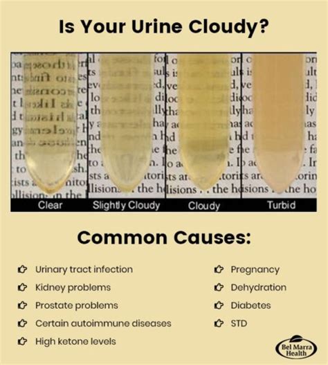 Common Causes of Cloudy Urine & Treatment Tips - Bel Marra Health