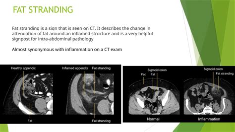 BASICS AND PRINCIPLES OF CT SCAN and windowing.pptx