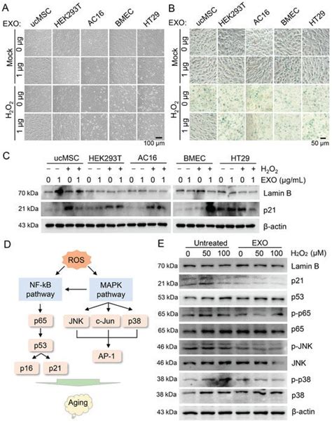 Umbilical Cord Mesenchymal-Stem-Cell-Derived Exosomes Exhibit Anti ...