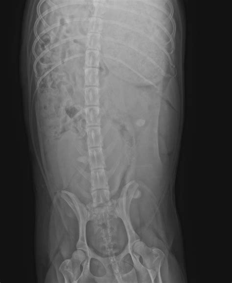 Anatomy Of A Pregnant Dog Bones : Thanksihateit