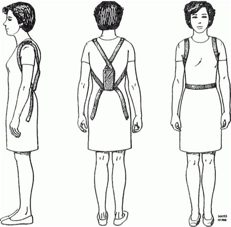 Back Extensor Muscles 的图像结果