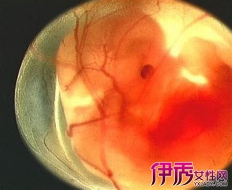 卵黄囊及胚芽大小孕周对照表，孕几周可见看这里就知道_家庭医生在线