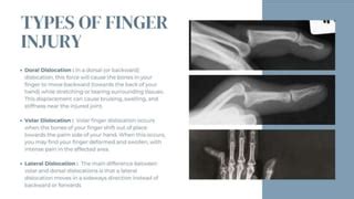 Image result for Finger Dislocation Reduction