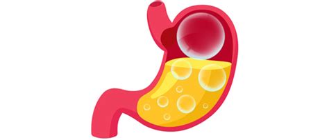 Banish Bloating with 15 Effective Home Remedies