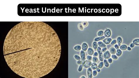 Pseudomonas Aeruginosa Under Microscope (Gram Staining) - Biology Notes Online