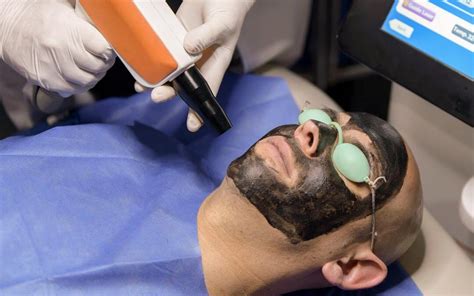 Facial Aclarante & Hollywood Peel Mens – E´Lu Clinic & Spa