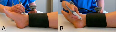 Ankle-Brachial Index Procedures Using Unit IX 的图像结果