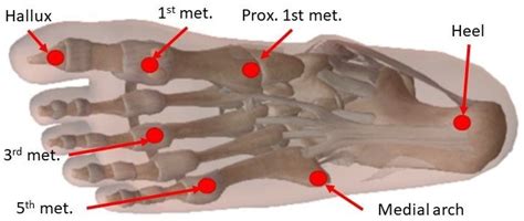 Can the Plantar Pressure and Temperature Data Trend Show the Presence ...