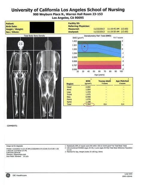 Image result for Dexa Scan Interpretation