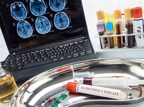 How does aging affect your ability to regulate body temperature – HelpDementia.com