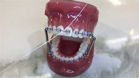 Image result for Using a Floss Threader