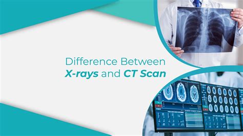 Difference between X-rays and CT scans | Dr. Remedies Labs