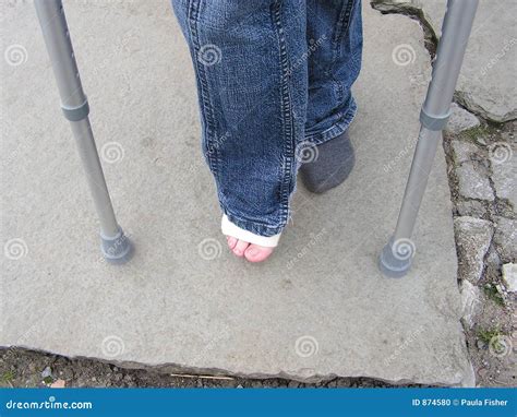 Sprained Ankle & Crutches Stock Photo - Image of feet, strain: 874580