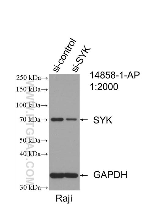 SYK antibody (14858-1-AP) | Proteintech