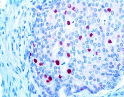 Image result for P21 Tutorial