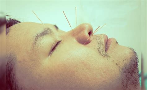 Facial acupuncture क्या है? जानिए कैसे ये छोटी सी सुई है कई स्वास्थ्य ...