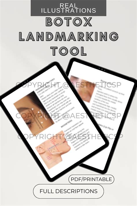 Image result for Botox Injection Guide