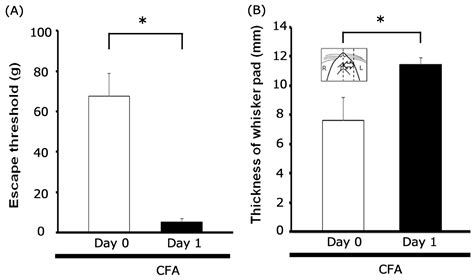 Epigallocatechin-3-Gallate Suppresses Hyperexcitability in Rat Primary ...