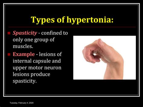 Muscle Spindle Stretch Reflex 的图像结果