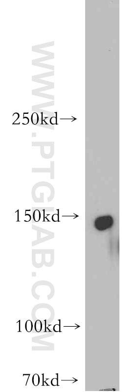 ADCY8 antibody (55065-1-AP) | Proteintech