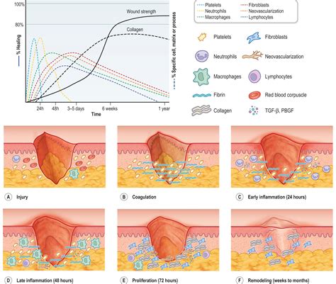 Scar prevention, treatment, and revision - Clinical Tree