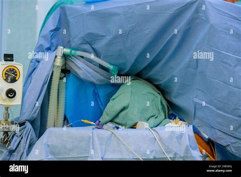 Image result for Operating Room Procedures Patient