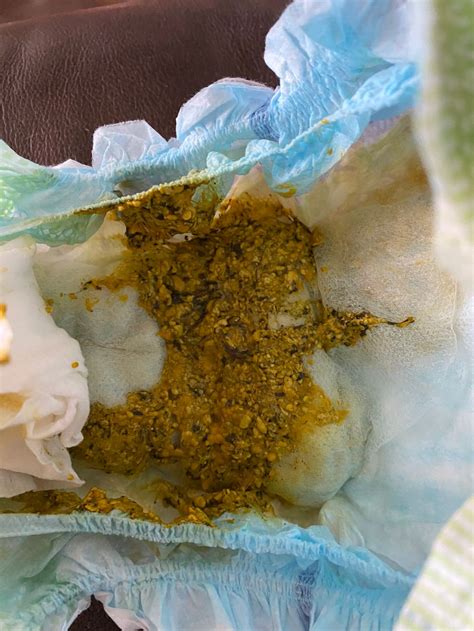 Seedy Mustard Watery Poop Newborn