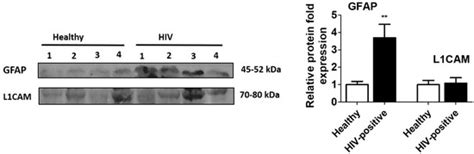 Circulatory Astrocyte and Neuronal EVs as Potential Biomarkers of ...