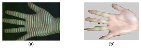 Sensor Architectures and Technologies for Upper Limb 3D Surface ...