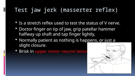 trigeminal nerve and their disease222ptx | PPTX