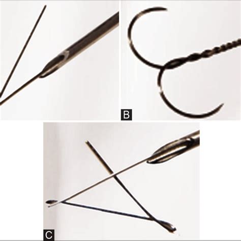 Wire Localization Procedure 的图像结果