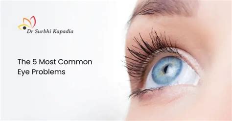 Image result for Common Eye Problems