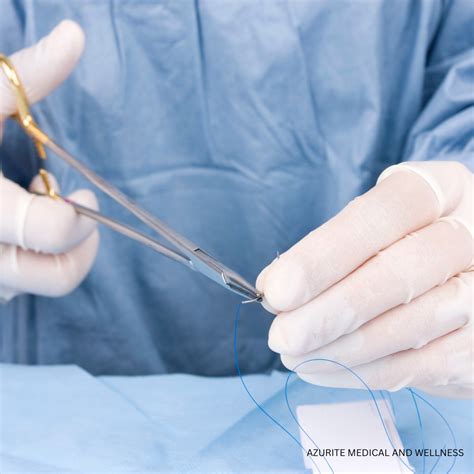 Understanding the Role of Dissolvable Stitches in Facelifts