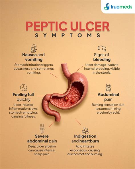 Stomach Peptic Ulcer Symptoms