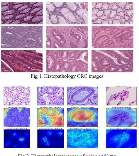 Image result for Colon Classification Part