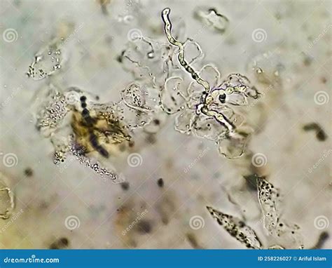 Abnormal Urine Analysis with Copy Space. Epithelial Cell, Pus Cell, RBC Stock Image - Image of ...